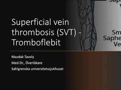 Superficial vein thrombosis (SVT)
