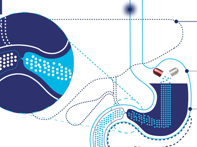 Creon är en pankreasenzymersättningsterapi